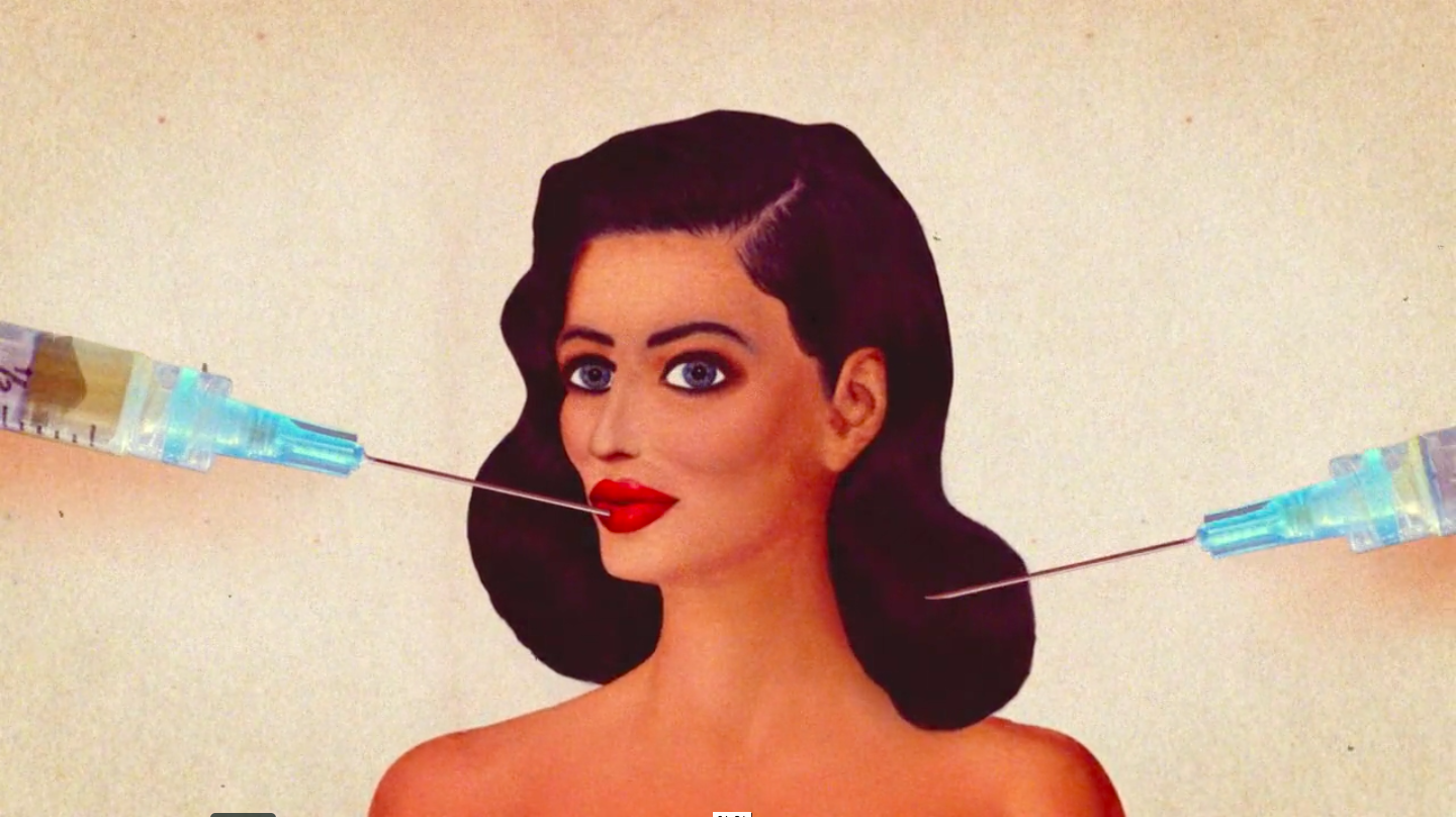 supervenus | Collater.al