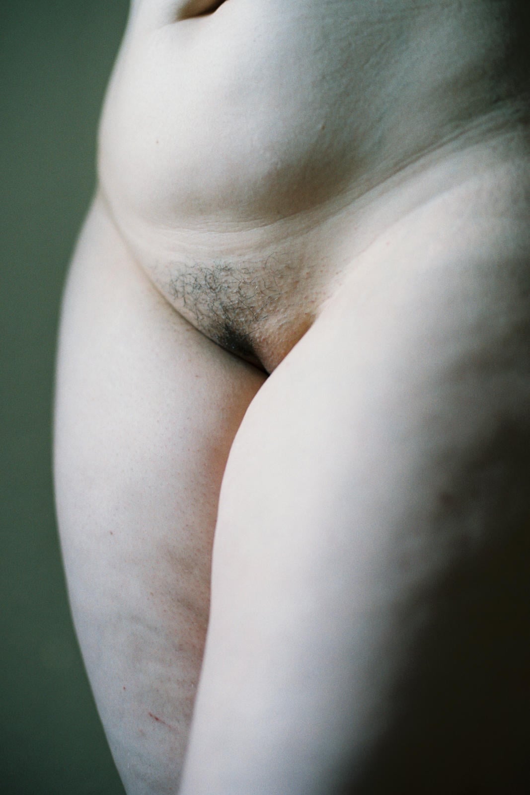 Patient.Wolves | Collater.al