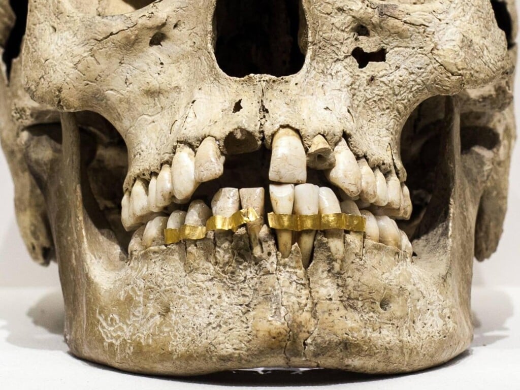 grillz
