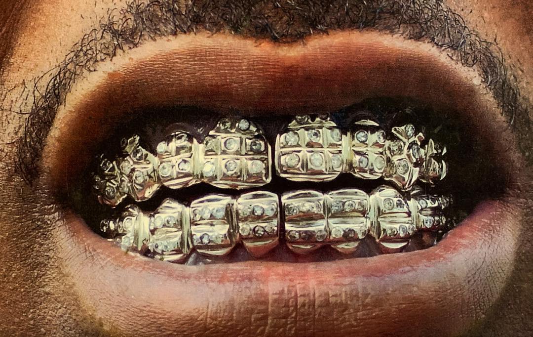 The story of the grillz and the man who invented it | Collater.al